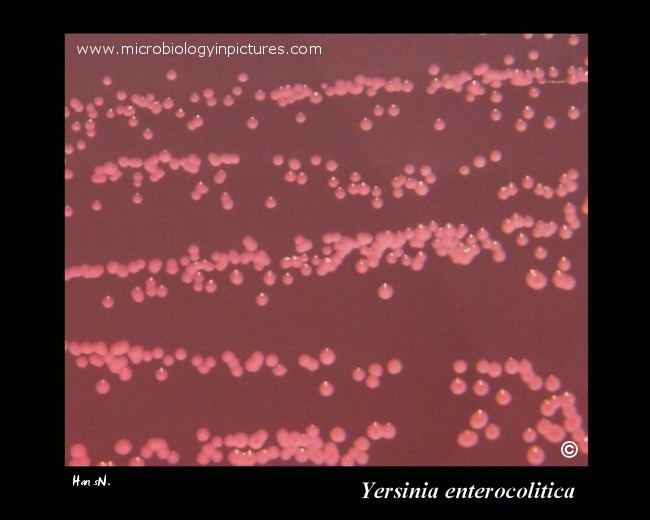 yersinia lactose negative colonies on Endo